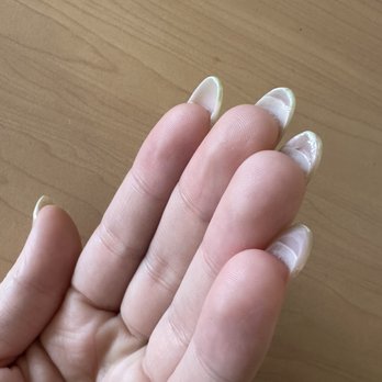 Eclipse Nail Bar - left the nails extremely thick underneath - Nail Salons Near Me - San Jose, California Eclipse Nail Bar - left the nails extremely thick underneath - Nail Salons Near Me - San Jose, California