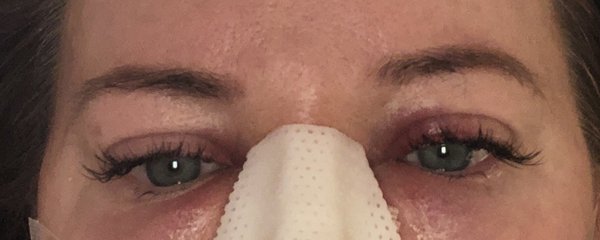 Min S Ahn, MD, FACS - The Minilift Center