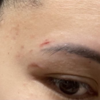 Isalon - Burnt skin from wax - Hair Salons Near Me - Portland, Oregon