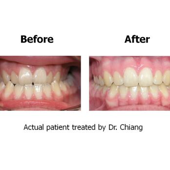 CHIANG ORTHODONTICS - Updated December 2025 - 16 Photos & 35