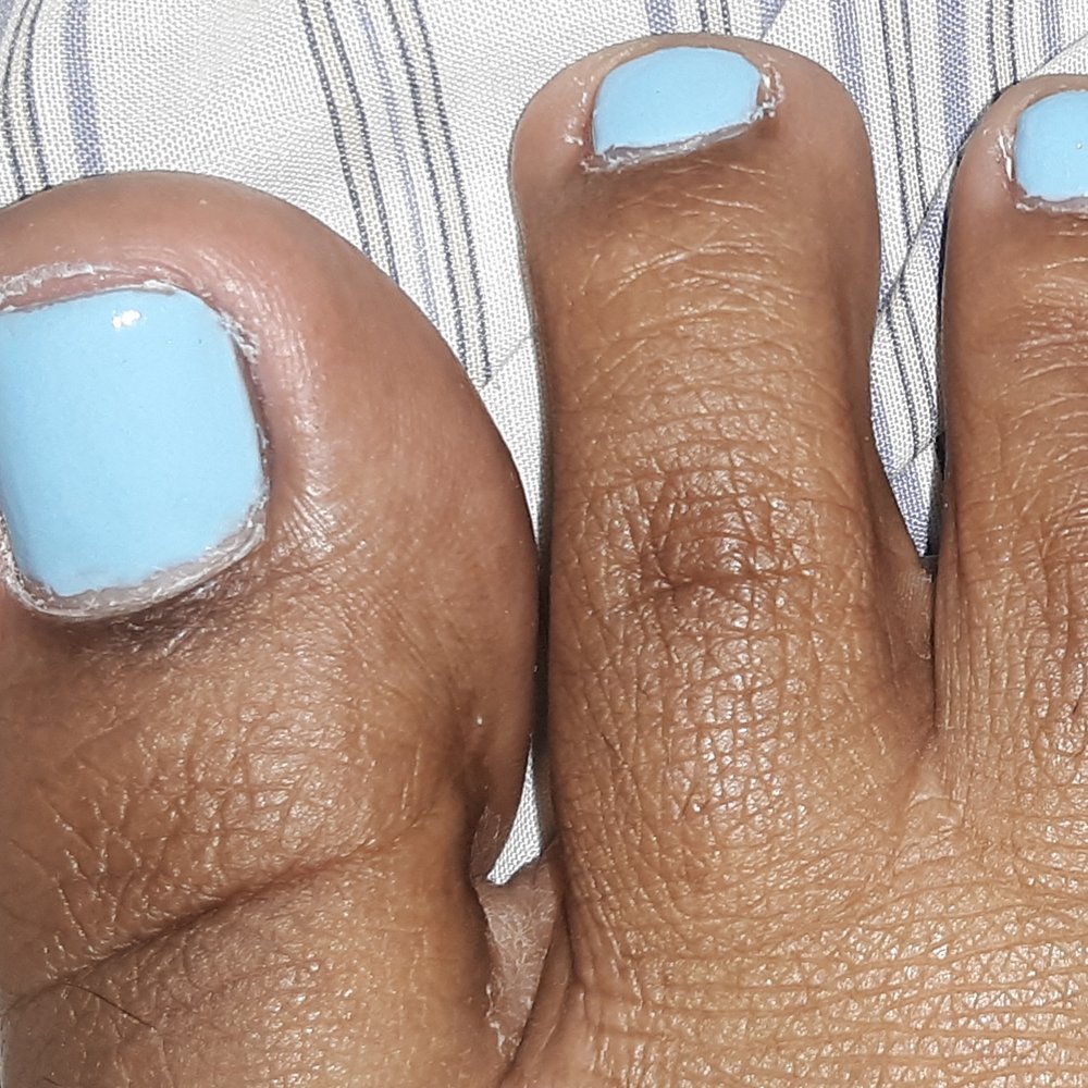 Ritzy Nails & Spa - Toes are dry and cracked after "pedicure" - Nail Salons Near Me - East Orange, New Jersey Ritzy Nails & Spa - Toes are dry and cracked after "pedicure" - Nail Salons Near Me - East Orange, New Jersey