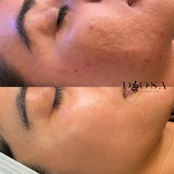 Before and after