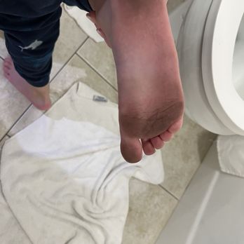 Anchorage By the Sea - My son's feet after walking barefoot in the room on their filthy carpets. - Hotels Near Me - Ogunquit, Maine