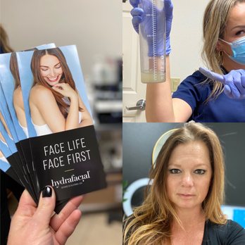 Loma Linda Aesthetics - Hydra facial with some additional stuff - Medical Spas Near Me - Beaumont, California