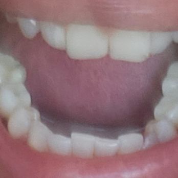 Contemporary Dental Care- Emergency Dentist Altamonte Spring - Orthodontists Near Me - Altamonte Springs, Florida