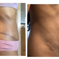Arvin Taneja, MD - My Look - Side