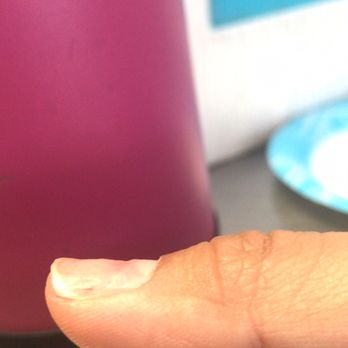 Brilliant Nails & Spa - Top left is where the natural nail bed and shaving should stop - Nail Salons Near Me - Laguna Woods, California