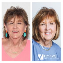 Revive Dental Implant Center - Revive Dental Implant Center. Mesa, AZ. Dental Implants