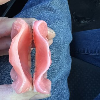 Affordable Dentures & Implants - Look how thick the left one is. Which one looks more comfortable? Which one looks more professional? - General Dentistry Near Me - Fort Wayne, Indiana Affordable Dentures & Implants - Look how thick the left one is. Which one looks more comfortable? Which one looks more professional? - General Dentistry Near Me - Fort Wayne, Indiana