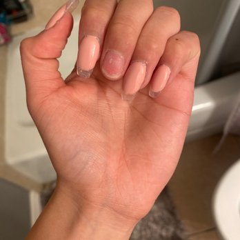 Lotus Nail Bar - This is how ugly my nails Looked after four days. - Nail Salons Near Me - Hesperia, California