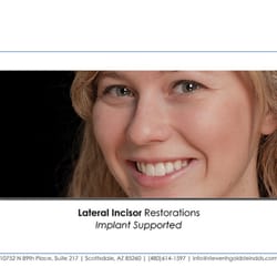Steven H Goldstein, DDS - Dental Before and After