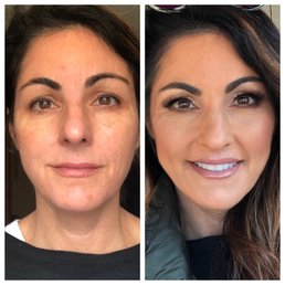 Before/After