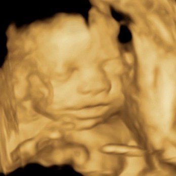 4D Miracles - Ultrasound Imaging Centers Near Me - Fremont, California 4D Miracles - Ultrasound Imaging Centers Near Me - Fremont, California