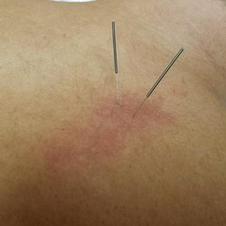 Laurel County Physiatry and Pain