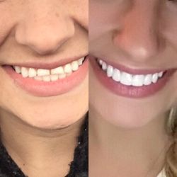 Summerhill Dental Excellence: Dr. Roger Lerner