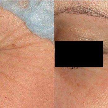 Green Clinic - Skin Care Near Me - Toronto, Ontario Green Clinic - Skin Care Near Me - Toronto, Ontario
