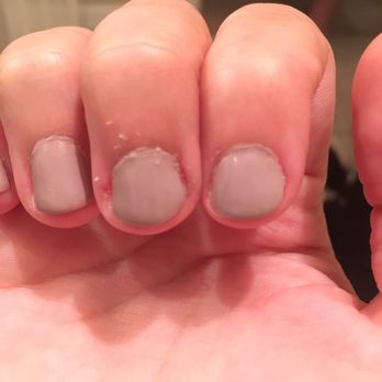 Cali ProNail - Uneven layers of nail polish. Filed my nails down as far as she possibly could. - Nail Salons Near Me - Clearwater, Florida Cali ProNail - Uneven layers of nail polish. Filed my nails down as far as she possibly could. - Nail Salons Near Me - Clearwater, Florida