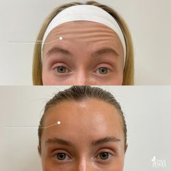 True Jewel Cosmetic & Plastic Surgery Center - Botox