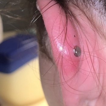 North York Ink - you can see the one piercing on top fell out. - Tattoo Near Me - Toronto, Ontario North York Ink - you can see the one piercing on top fell out. - Tattoo Near Me - Toronto, Ontario