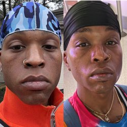 Asha Esthetic - My before and my after. My skin is so shiny and vibrant on the right compared to the one on the left, that looks dull and lacking moisture