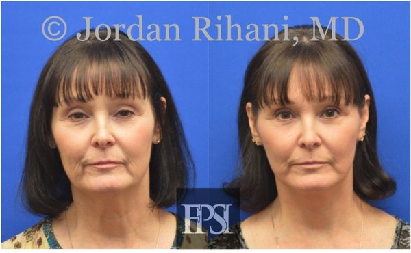 FACIAL PLASTIC SURGERY INSTITUTE - Updated August 2024 - 17 Photos & 10 