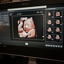 Stork 4D Imaging Studio - 31 weeks 1 day