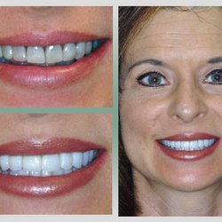 Harmony Dental Care - Kalil Abide - Smile Makeover