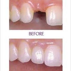 Robert L Cohen, DDS