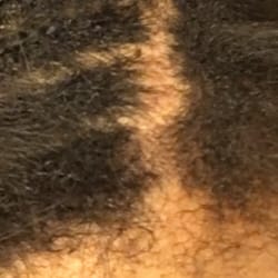Unique Hair Salon - This is not a part. This is from the stylist scalping me bald from the horrible sew in she did.