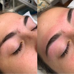 Before & after