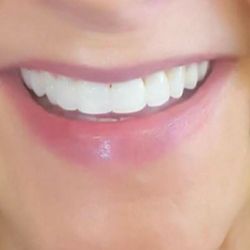 Cindy's Mint Chocolate Spa&Medical Massage Rehabilitation Clinic - Teeth Whitening