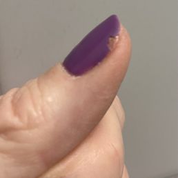 24 hours after gel 24 hours after gel