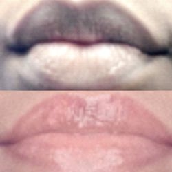 Norvana Beauty - Dark Lip Corrections