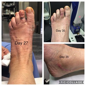 Liddy Podiatry & Prevention - Left foot - Podiatrists Near Me - Beverly Hills, California Liddy Podiatry & Prevention - Left foot - Podiatrists Near Me - Beverly Hills, California