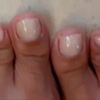 NailHouse & Spa - red nicks every toe corner - Nail Salons Near Me - Hollywood, Florida NailHouse & Spa - red nicks every toe corner - Nail Salons Near Me - Hollywood, Florida