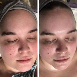 The Skin Therapist Kristi