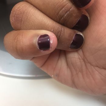 Juju's Nail & Spa - So disgusting how they left all this dead skin around my nails. Paying for a service not a half done job. - Nail Salons Near Me - Fresh Meadows, New York Juju's Nail & Spa - So disgusting how they left all this dead skin around my nails. Paying for a service not a half done job. - Nail Salons Near Me - Fresh Meadows, New York