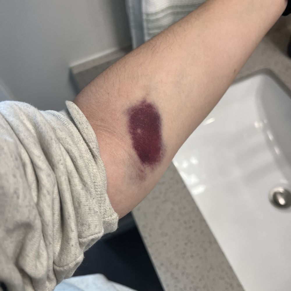 Quest Diagnostics - after blood work - Laboratory Testing Near Me - Orlando, Florida Quest Diagnostics - after blood work - Laboratory Testing Near Me - Orlando, Florida