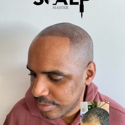 The Scalp Master