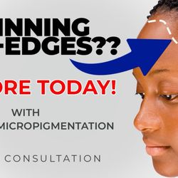 Restore Thinning Hair-Edges