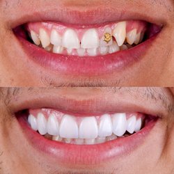 Samira Seini Dentistry