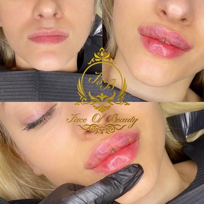 Face Of Beauty by null