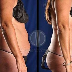 CWC Cosmetic Surgery