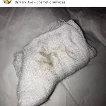 Park Avenue - That's my peach fuzz! - Medical Spas Near Me - Franklin Lakes, New Jersey