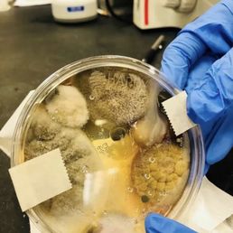 Feces, bacteria Feces, bacteria