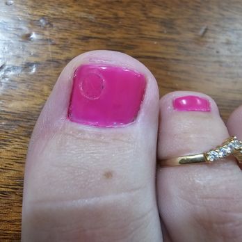 Best Nails Spa - This shows it clear as day after 24 hours..... - Nail Salons Near Me - Sarasota, Florida
