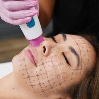 LaserAway - Tattoo Removal Near Me - Beaverton, Oregon LaserAway - Tattoo Removal Near Me - Beaverton, Oregon