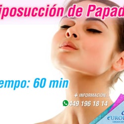 Euroderma - Liposuccion de papada con anestesia local en quirófano en tan solo 20 minutos en promoción en $10000