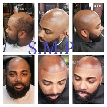 Big Herk's Clippers - S.MP...SCALP MICRO- PIGMENTAION - Barbers Near Me - Stockton, California Big Herk's Clippers - S.MP...SCALP MICRO- PIGMENTAION - Barbers Near Me - Stockton, California