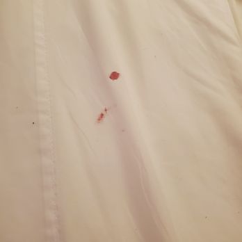 Oceanfront Lodge - BLOOD STAINED SHEETS - Hotels Near Me - Crescent City, California Oceanfront Lodge - BLOOD STAINED SHEETS - Hotels Near Me - Crescent City, California